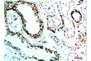 Immunohistochemical analysis of paraffin-embedded human-testis, antibody was diluted at 1:200 (IL-31 Antikörper  (AA 21-70))