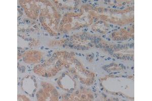 Used in DAB staining on fromalin fixed paraffin- embedded Kidney tissue (DPP7 Antikörper  (AA 28-486))