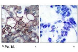 Image no. 2 for anti-Epidermal Growth Factor Receptor (EGFR) (pTyr1197) antibody (ABIN196974) (EGFR Antikörper  (pTyr1197))