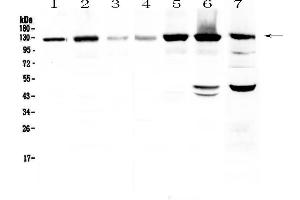 Western blot analysis of Eph receptor A2  using anti-Eph receptor A2  antibody . (EPH Receptor A2 Antikörper  (AA 851-970))