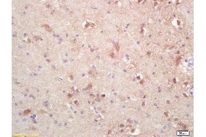 Formalin-fixed and paraffin embedded rat brain labeled with Rabbit Anti SOAT2/ACAT2 Polyclonal Antibody, Unconjugated  at 1:200 followed by conjugation to the secondary antibody and DAB staining (SOAT2 Antikörper  (AA 331-430))