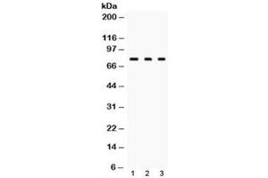 Western blot testing of TGM2 antibody and Lane 1:  rat liver, 2. (Transglutaminase 2 Antikörper)
