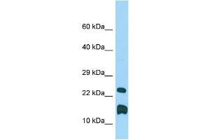 WB Suggested Anti-Lmo1 Antibody Titration: 1.