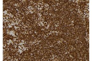 ABIN6262736 and ABIN6277134 at 1/100 staining Mouse spleen tissue by IHC-P. (KBTBD3 Antikörper  (C-Term))