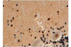 Image no. 2 for anti-Arrestin, beta 2 (ARRB2) (Internal Region) antibody (ABIN374557) (Arrestin 3 Antikörper  (Internal Region))