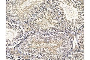 ABIN7096253 and ABIN7100315 at 1/100 staining rat testis tissue by IHC-P. (EPG5 Antikörper)