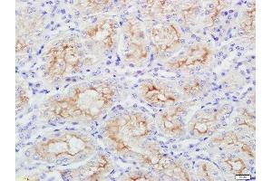 Immunohistochemistry (Paraffin-embedded Sections) (IHC (p)) image for anti-Secreted Protein, Acidic, Cysteine-Rich (Osteonectin) (SPARC) (AA 101-200) antibody (ABIN738141)