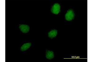 Immunofluorescence of purified MaxPab antibody to C17orf66 on HeLa cell. (C17orf66 Antikörper  (AA 1-219))