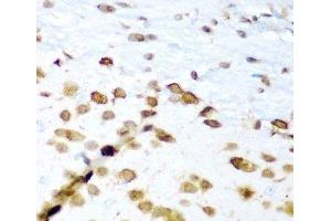 Immunohistochemistry of paraffin-embedded Mouse brain using ELAVL3 Polyclonal Antibody at dilution of 1:200 (40x lens).