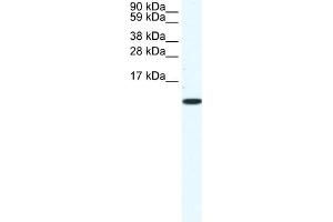 WB Suggested Anti-CCL5 Antibody Titration:  1. (CCL5 Antikörper  (Middle Region))