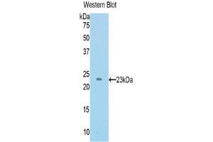 Western Blotting (WB) image for anti-TIMP Metallopeptidase Inhibitor 4 (TIMP4) (AA 42-224) antibody (ABIN1172385) (TIMP4 Antikörper  (AA 42-224))