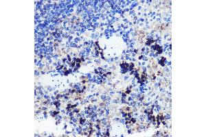 Immunohistochemistry of paraffin-embedded Rat spleen using FCHSD1 Rabbit pAb (ABIN7270317) at dilution of 1:100 (40x lens). (FCHSD1 Antikörper  (AA 100-400))