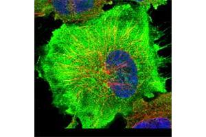 Immunofluorescent staining of human cell line U-251 MG shows positivity in plasma membrane & cytoplasm. (C9 Antikörper)