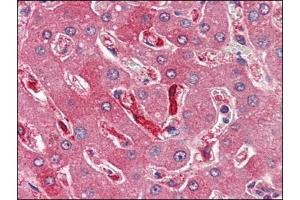 Human Liver (formalin-fixed, paraffin-embedded) stained with FTH1at 4 µg/ml followed by biotinylated anti-goat IgG secondary antibody, alkaline phosphatase-streptavidin and chromogen. (FTH1 Antikörper  (C-Term, Heavy Chain))