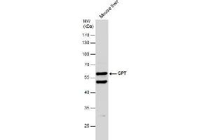 WB Image Mouse tissue extract (50 μg) was separated by 10% SDS-PAGE, and the membrane was blotted with GPT antibody [N1N3] , diluted at 1:500.