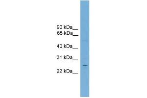 WB Suggested Anti-NR6A1 Antibody Titration:  0.