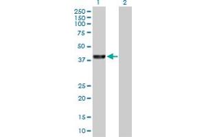 Western Blot analysis of PARK2 expression in transfected 293T cell line by PARK2 MaxPab polyclonal antibody.