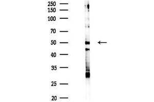 Western blot analysis of lysates from K562 cells(heat-shock 45 min treatment), using Phospho-SHC (Tyr427) Antibody at 1/1000 dilution.