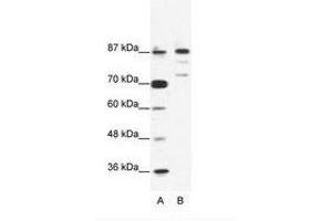 Image no. 1 for anti-BTB and CNC Homology 1, Basic Leucine Zipper Transcription Factor 1 (BACH1) (C-Term) antibody (ABIN203248)