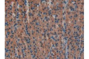 DAB staining on IHC-P; Samples: Rat Stomach Tissue (Lactate Dehydrogenase A Antikörper  (AA 1-332))