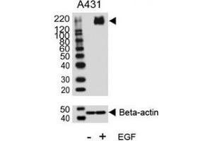 Western blot analysis of lysate from A431 cell line, untreated or treated with EGF (100ng/ml), using phospho-ErbB2 antibody. (ErbB2/Her2 Antikörper  (pTyr1140))