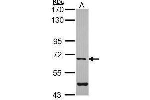 WB Image Sample (30 ug of whole cell lysate) A: H1299 7. (ARSG Antikörper)