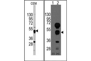 Image no. 1 for anti-GATA Binding Protein 4 (GATA4) (C-Term) antibody (ABIN356870) (GATA4 Antikörper  (C-Term))