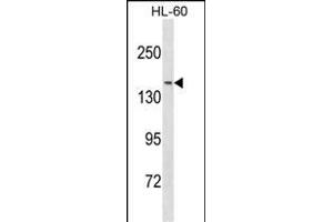 NCOA3 Antibody (N-term) (ABIN1881566 and ABIN2838818) western blot analysis in HL-60 cell line lysates (35 μg/lane). (NCOA3 Antikörper  (N-Term))