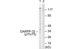 Western Blotting (WB) image for anti-Protein Phosphatase 1, Regulatory (Inhibitor) Subunit 1B (PPP1R1B) (pThr75) antibody (ABIN1847208) (DARPP32 Antikörper  (pThr75))