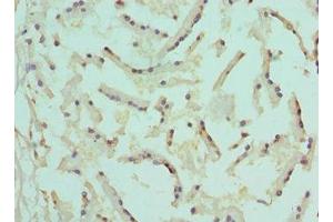 Immunohistochemistry of paraffin-embedded human prostate tissue using ABIN7148788 at dilution of 1:100 (AFT1 Antikörper  (AA 1-210))