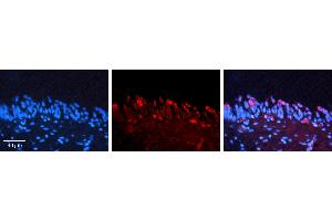 Rabbit Anti-SMAD3 Antibody   Formalin Fixed Paraffin Embedded Tissue: Human Urinary Bladder Tissue Observed Staining: Cytoplasm Primary Antibody Concentration: 1:100 Other Working Concentrations: N/A Secondary Antibody: Donkey anti-Rabbit-Cy3 Secondary Antibody Concentration: 1:200 Magnification: 20X Exposure Time: 0.