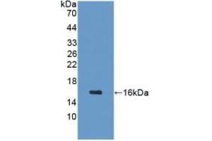 Detection of Recombinant GHRH, Mouse using Polyclonal Antibody to Growth Hormone Releasing Hormone (GHRH) (GHRH Antikörper  (AA 20-97))
