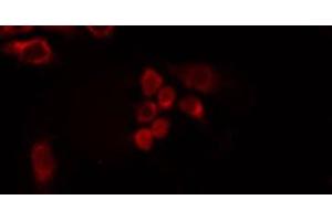 ABIN6275428 staining HepG2 by IF/ICC. (PDXDC1 Antikörper  (C-Term))
