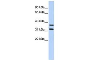 Image no. 1 for anti-Zinc Finger Protein 254 (ZNF254) (AA 151-200) antibody (ABIN6744476) (ZNF254 Antikörper  (AA 151-200))