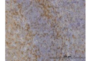 Image no. 1 for anti-Mitogen-Activated Protein Kinase 12 (MAPK12) (AA 251-368) antibody (ABIN598915) (MAPK12 Antikörper  (AA 251-368))