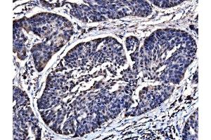 IHC analysis of HSPA6 using anti-HSPA6 antibody (ABIN7601944). (HSPA6 Antikörper  (AA 516-643))