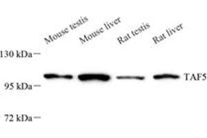 Western blot analysis of TAF5 (ABIN7075828),at dilution of 1: 800 (TAF5 Antikörper)