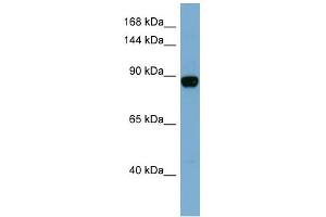 WB Suggested Anti-CASD1 Antibody Titration:  0. (CASD1 Antikörper  (N-Term))