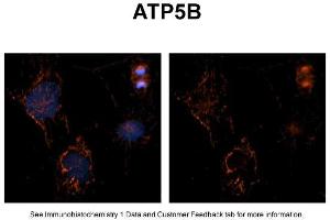 Sample Type: NT2 cellsRed: AntibodyBlue: DAPIPrimary Dilution: 1ug/50ul antibodySecondary Antibody: Alexa goat anti-rabbit 594Image Submitted by: Yuzhi Chen, University of Arkansas for Medical Sciences (ATP5B Antikörper  (C-Term))