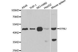 Western blot analysis of extracts of various cell lines, using KYNU antibody.