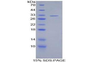 SDS-PAGE (SDS) image for S-Antigen, Retina and Pineal Gland (Arrestin) (SAG) (AA 139-388) protein (His tag) (ABIN1878939)