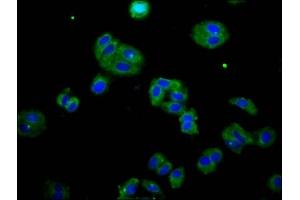 Immunofluorescence staining of HepG2 cells with ABIN7165300 at 1:133, counter-stained with DAPI. (DOK7 Antikörper  (AA 416-504))