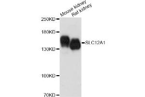 Western blot analysis of extracts of various cell lines, using SLC12A1 antibody. (SLC12A1 Antikörper)