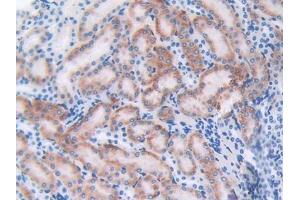 DAB staining on IHC-P; Samples: Mouse Kidney Tissue (CTLA4 Antikörper  (AA 45-185))