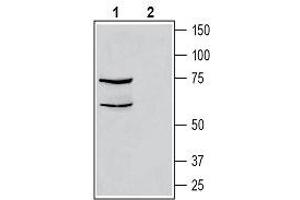 Western blot analysis of human THP-1 monocytic leukemia cell line lysate: - 1. (CALCRL Antikörper  (C-Term, Intracellular))