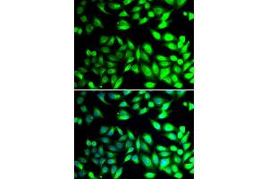 Immunofluorescence analysis of U20S cell using PDIA6 antibody. (PDIA6 Antikörper)
