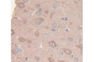 IHC-P analysis of Rat Tissue, with DAB staining. (KIF5A Antikörper  (AA 823-1027))