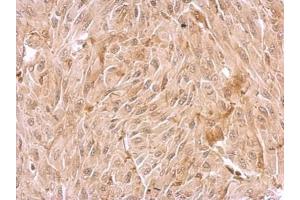 Immunohistochemistry (IHC) image for anti-WD Repeat Domain 1 (WDR1) (C-Term) antibody (ABIN2855326)