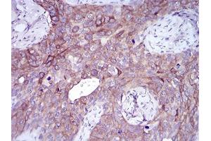 Immunohistochemistry (IHC) image for anti-Snail Family Zinc Finger 2 (SNAI2) (AA 100-200) antibody (ABIN5542256)
