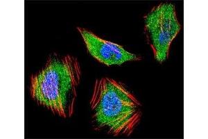 Fluorescent confocal image of HeLa cell stained with SMAD4 antibody at 1:25. (SMAD4 Antikörper  (AA 400-428))